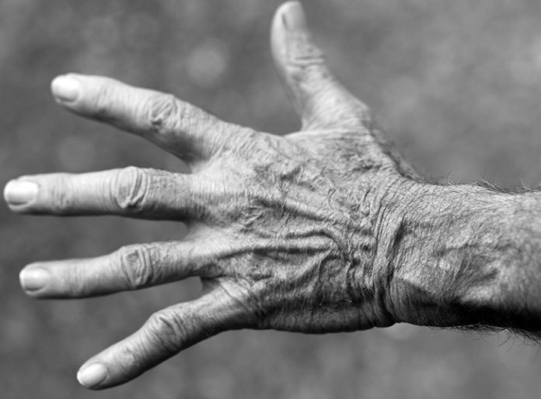 50 &eacute;v felett szinte k&ouml;telező a csontsűrűs&eacute;g-vizsg&aacute;lat