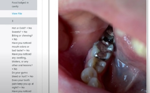 Egyre elterjedtebbé válik a távoli fogászat 