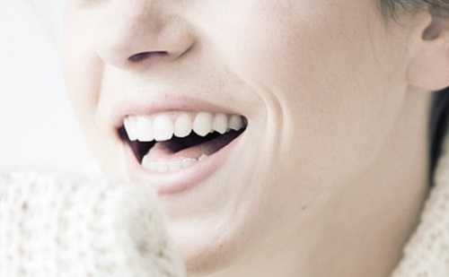 Természetes hatás és tartósság – 3 ok, amiért érdemes fogászati implantátumot beültetni