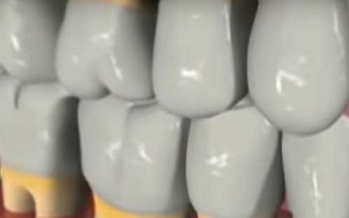 Hogyan vezethet súlyos betegségekhez a fogak elhanyagolása? 