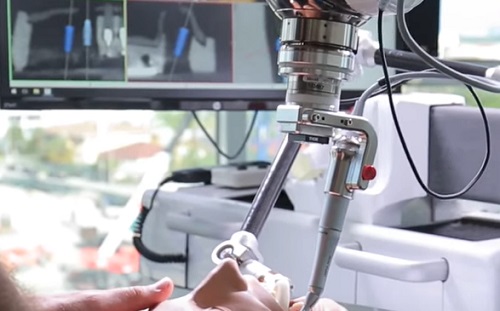 Így ültet be fogászati implantátumot egy robot