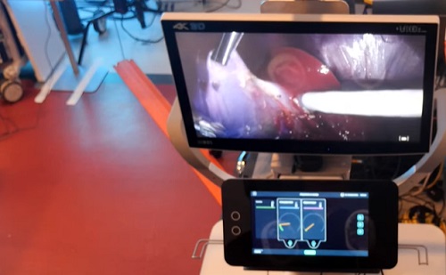 Élő tesztelés - Mérföldkőhöz ért a Luna sebészeti robotrendszer
